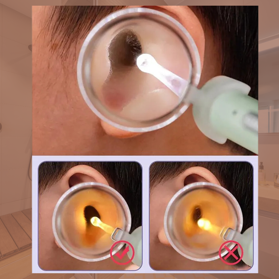 The Earbrite